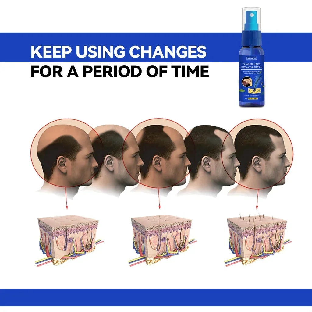 Ginger Hair Growth spray Anti  Fall  Loss Treatment   Essence Oil for Men Women hair treatment